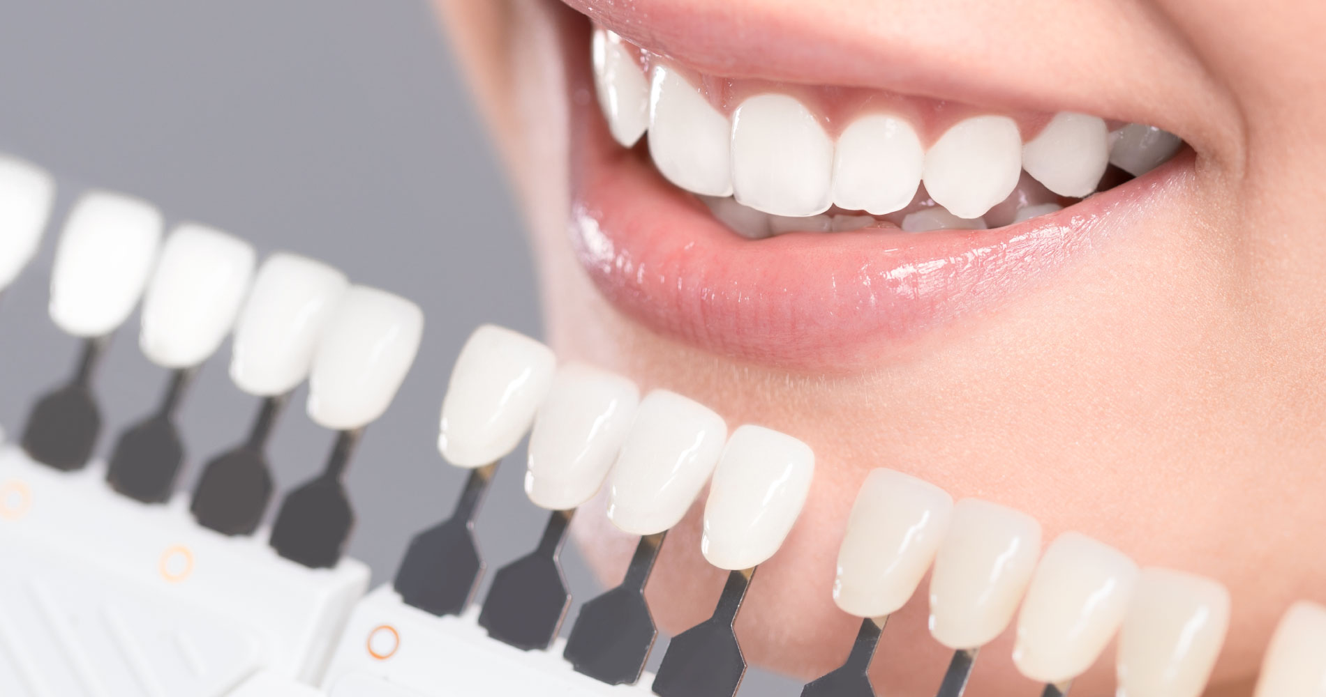 cosmetic-dentristry1